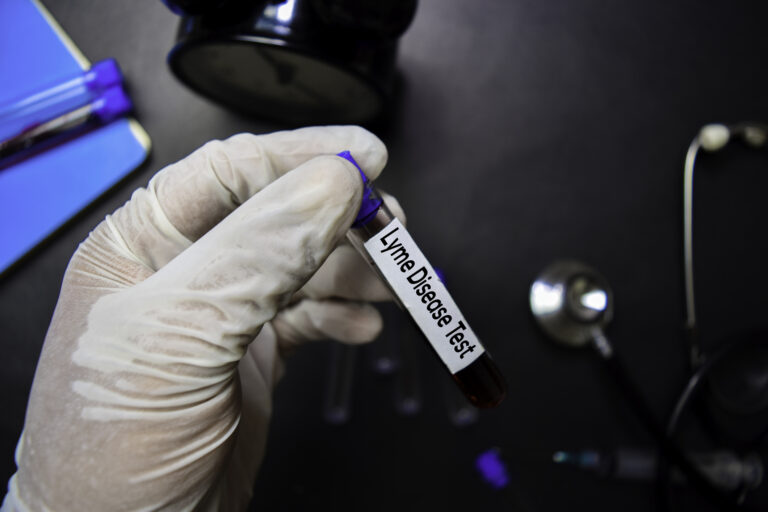 St. Francis Physician Involved in Study to Create a Single, More Accurate Lyme Disease Test